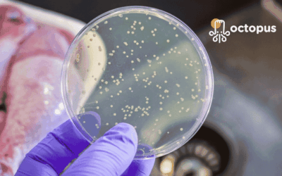 Bactéries en cuisine : quels sont les risques et comment les maîtriser avec la méthode HACCP ?